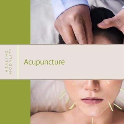 Acupuncture